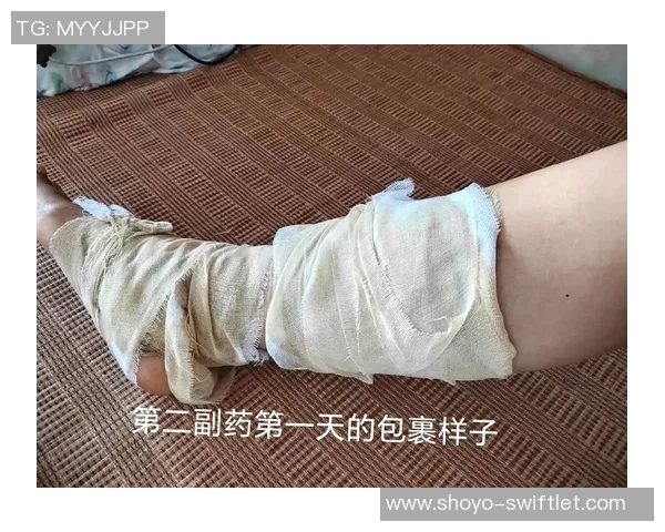 巴黎官方确认马尤卢右小腿受伤将在未来两周内进行治疗